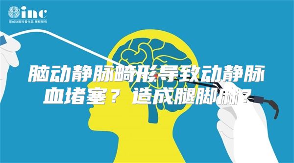 脑动静脉畸形导致动静脉血堵塞？造成腿脚麻？