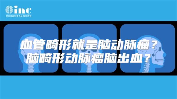 血管畸形就是脑动脉瘤？脑畸形动脉瘤脑出血？