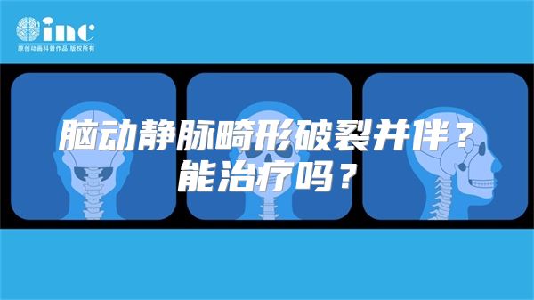 脑动静脉畸形破裂并伴？能治疗吗？