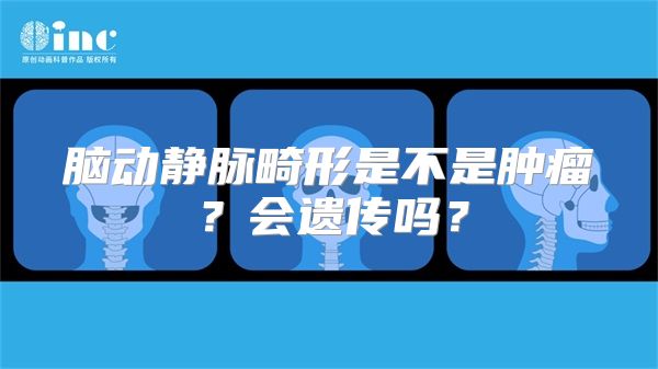 脑动静脉畸形是不是肿瘤？会遗传吗？