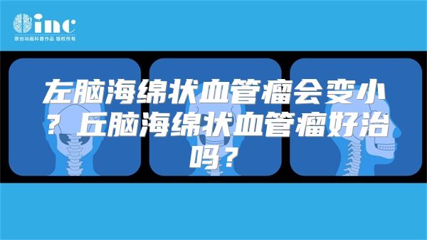 左脑海绵状血管瘤会变小？丘脑海绵状血管瘤好治吗？