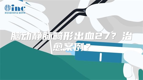 脑动静脉畸形出血27？治愈案例？