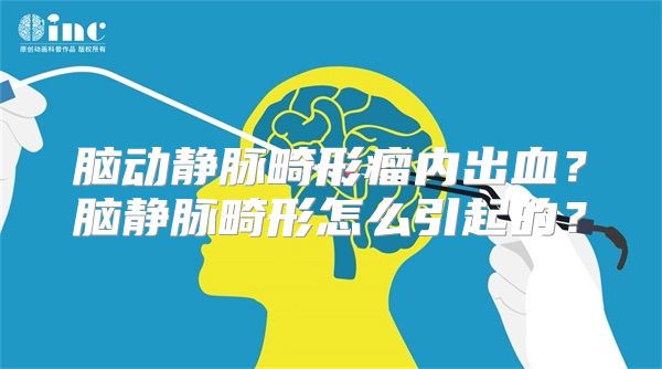 脑动静脉畸形瘤内出血？脑静脉畸形怎么引起的？