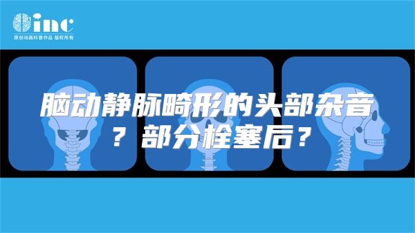 脑动静脉畸形的头部杂音？部分栓塞后？