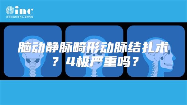 脑动静脉畸形动脉结扎术？4极严重吗？