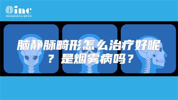 脑静脉畸形怎么治疗好呢？是烟雾病吗？