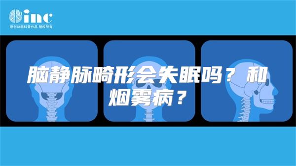 脑静脉畸形会失眠吗？和烟雾病？