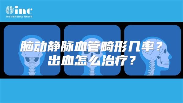 脑动静脉血管畸形几率？出血怎么治疗？