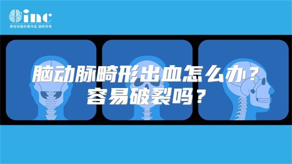 脑动脉畸形出血怎么办？容易破裂吗？