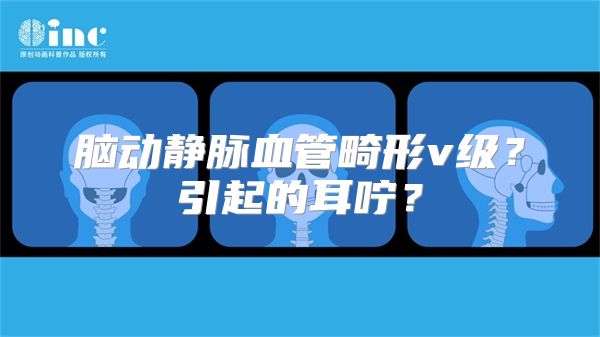 脑动静脉血管畸形v级？引起的耳咛？