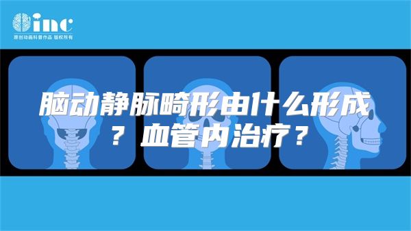 脑动静脉畸形由什么形成？血管内治疗？