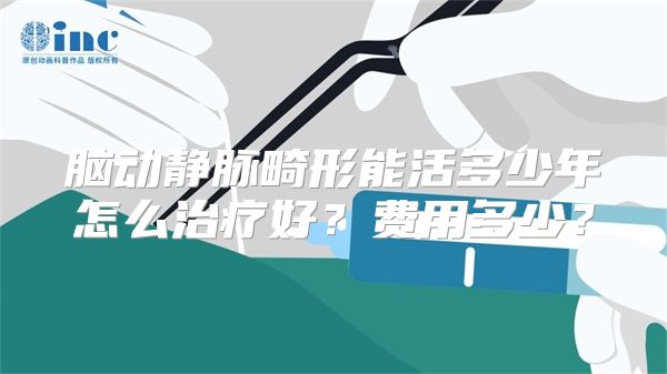 脑动静脉畸形能活多少年怎么治疗好？费用多少？