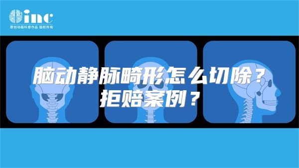 脑动静脉畸形怎么切除？拒赔案例？