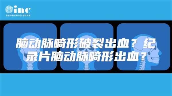 脑动脉畸形破裂出血？纪录片脑动脉畸形出血？