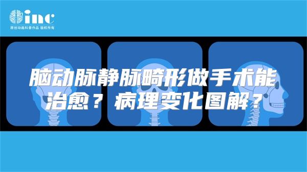 脑动脉静脉畸形做手术能治愈？病理变化图解？