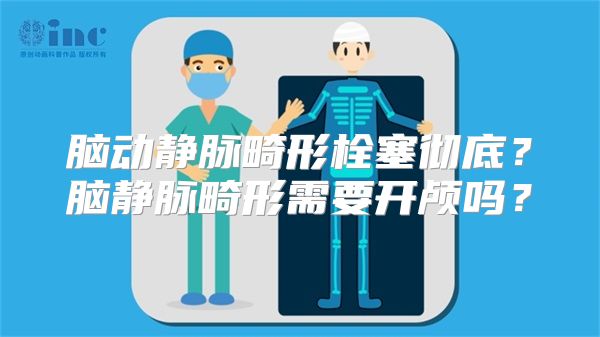 脑动静脉畸形栓塞彻底？脑静脉畸形需要开颅吗？