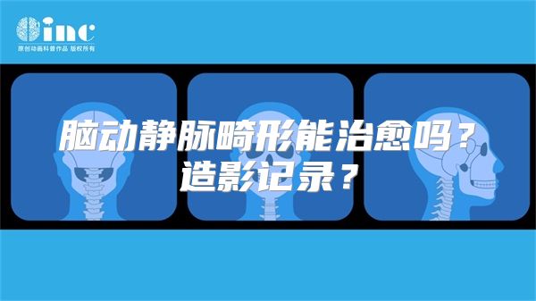 脑动静脉畸形能治愈吗？造影记录？