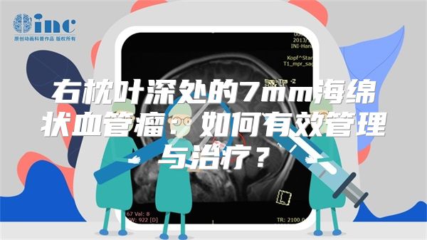 右枕叶深处的7mm海绵状血管瘤：如何有效管理与治疗？