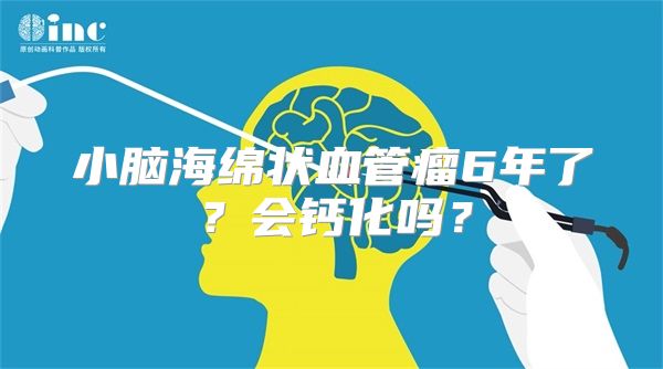 小脑海绵状血管瘤6年了？会钙化吗？