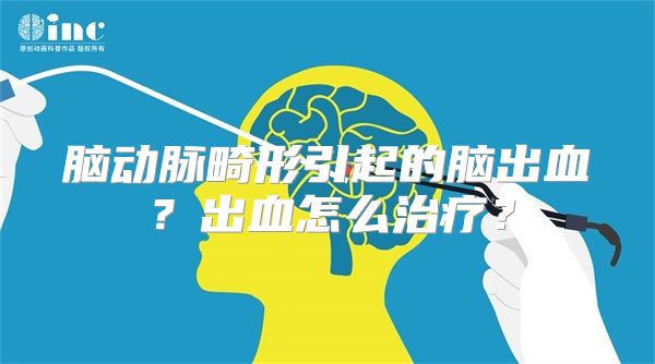 脑动脉畸形引起的脑出血？出血怎么治疗？