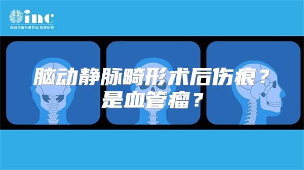 脑动静脉畸形术后伤痕？是血管瘤？