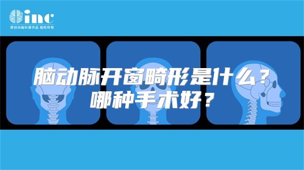 脑动脉开窗畸形是什么？哪种手术好？