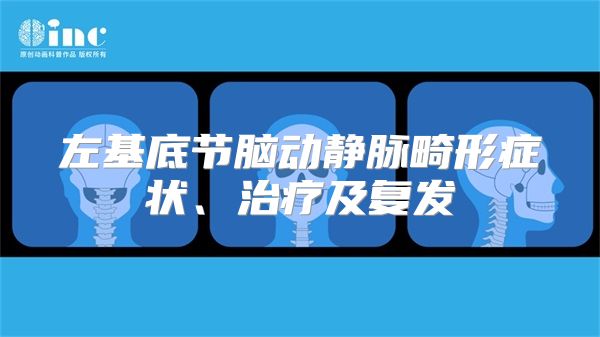 左基底节脑动静脉畸形症状、治疗及复发