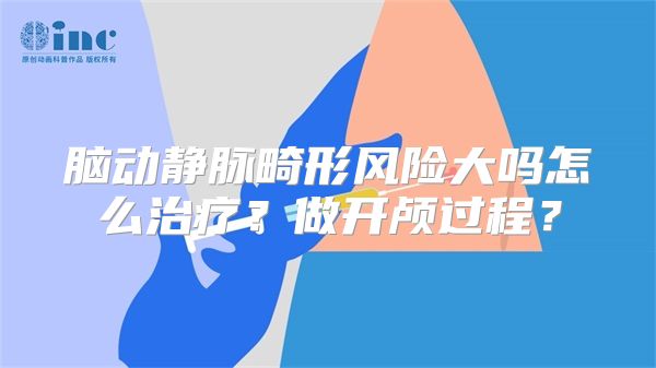 脑动静脉畸形风险大吗怎么治疗？做开颅过程？