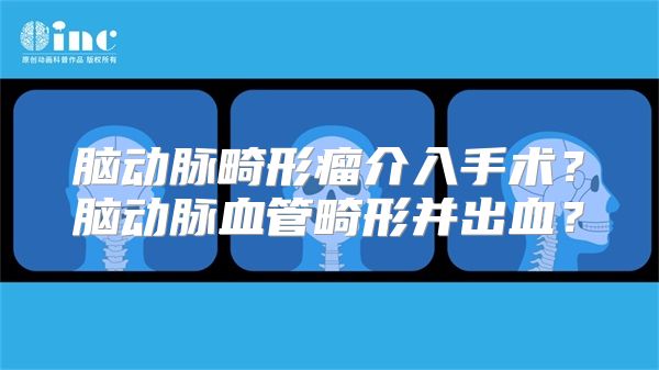 脑动脉畸形瘤介入手术？脑动脉血管畸形并出血？