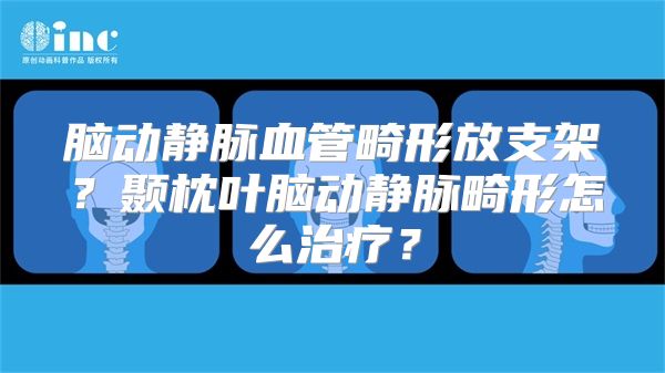 脑动静脉血管畸形放支架？颞枕叶脑动静脉畸形怎么治疗？