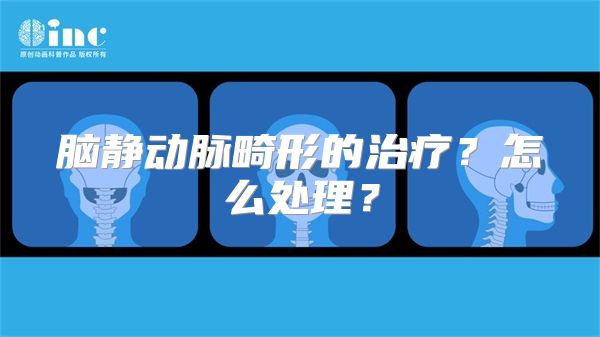 脑静动脉畸形的治疗？怎么处理？