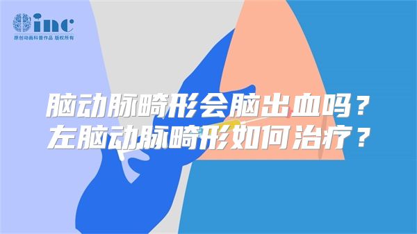 脑动脉畸形会脑出血吗？左脑动脉畸形如何治疗？