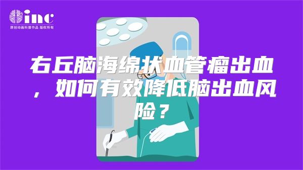 右丘脑海绵状血管瘤出血，如何有效降低脑出血风险？