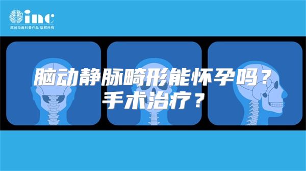 脑动静脉畸形能怀孕吗？手术治疗？