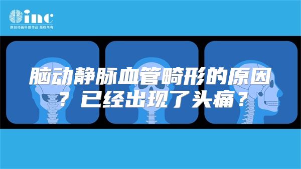 脑动静脉血管畸形的原因？已经出现了头痛？