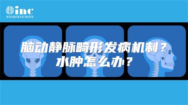 脑动静脉畸形发病机制？水肿怎么办？