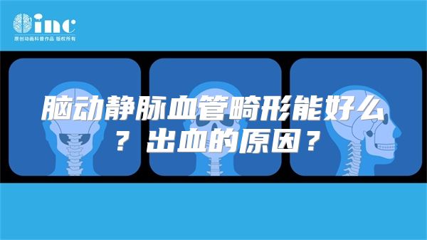 脑动静脉血管畸形能好么？出血的原因？