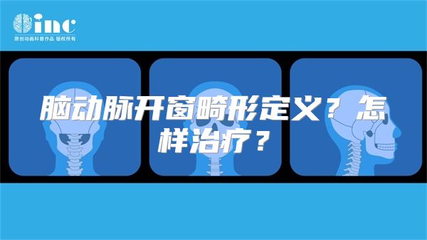 脑动脉开窗畸形定义？怎样治疗？