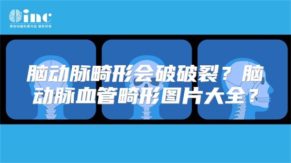 脑动脉畸形会破破裂？脑动脉血管畸形图片大全？