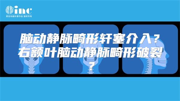 脑动静脉畸形轩塞介入？右额叶脑动静脉畸形破裂？