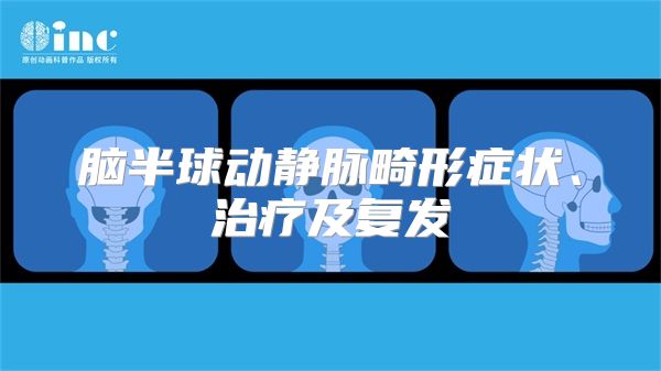 脑半球动静脉畸形症状、治疗及复发