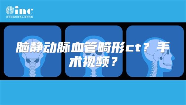 脑静动脉血管畸形ct？手术视频？