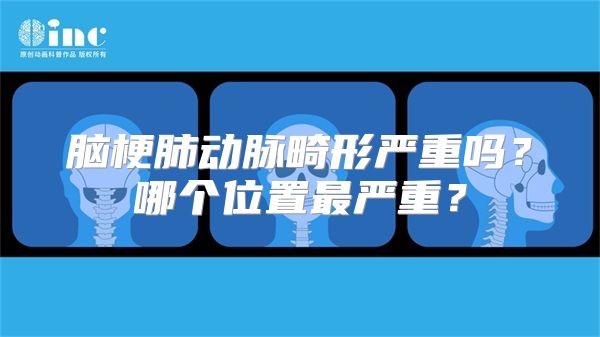 脑梗肺动脉畸形严重吗？哪个位置最严重？