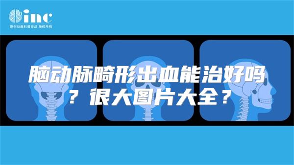 脑动脉畸形出血能治好吗？很大图片大全？