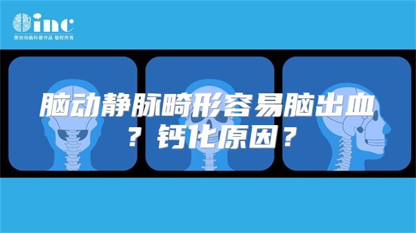 脑动静脉畸形容易脑出血？钙化原因？