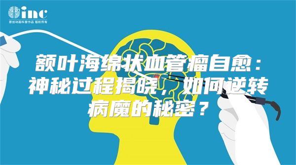 额叶海绵状血管瘤自愈：神秘过程揭晓，如何逆转病魔的秘密？