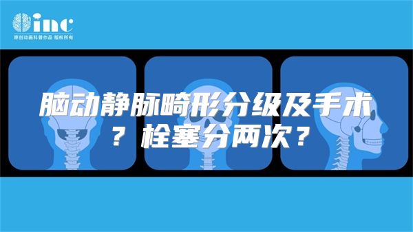 脑动静脉畸形分级及手术？栓塞分两次？