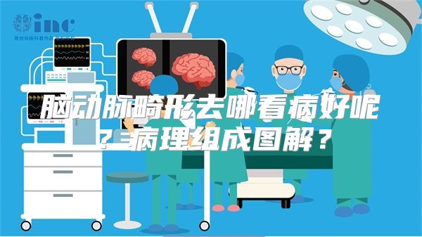 脑动脉畸形去哪看病好呢？病理组成图解？