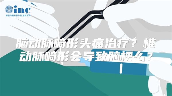 脑动脉畸形头痛治疗？椎动脉畸形会导致脑梗么？