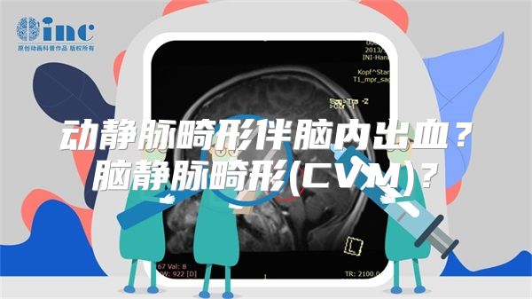 动静脉畸形伴脑内出血？脑静脉畸形(CVM)？